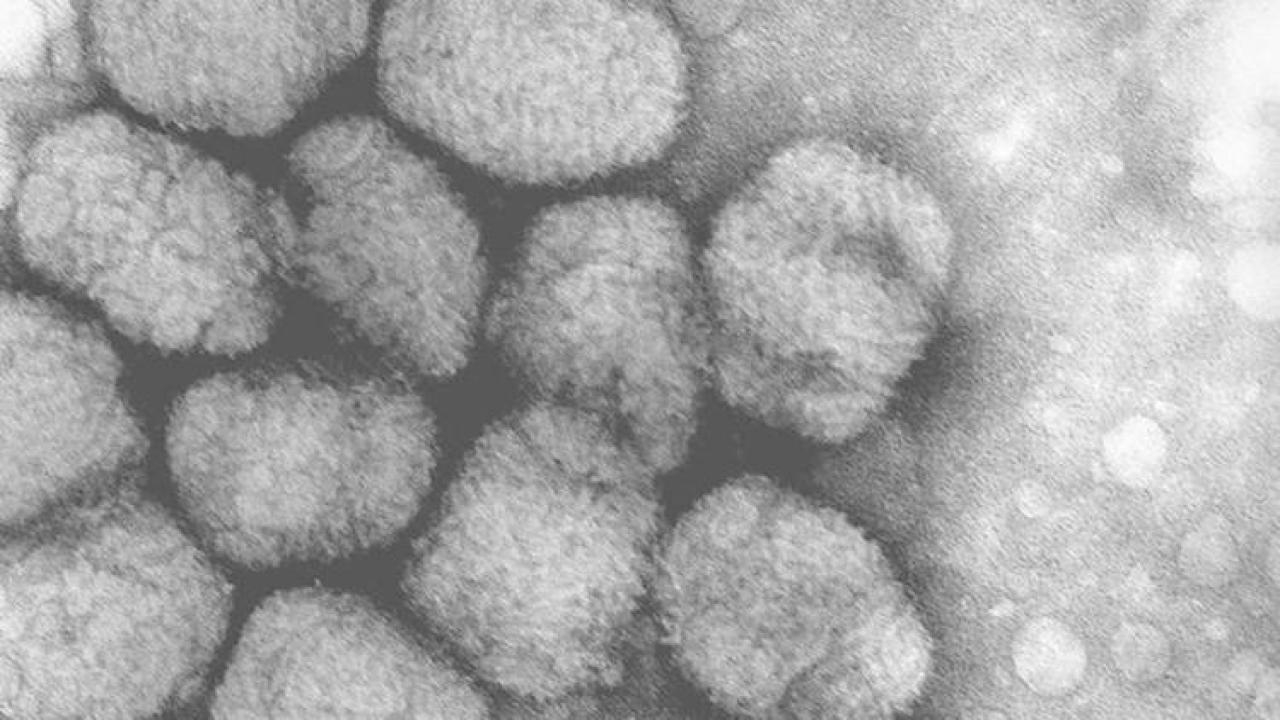 Alaskapox virüsü kaynaklı ilk ölüm kaydedildi