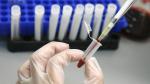 HIV tedavisinde tarihi adım: Virüs hücre içinde görünür hâle getirildi