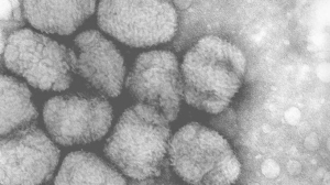 Alaskapox virüsü kaynaklı ilk ölüm kaydedildi