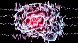 Epilepsi nöbetlerini tetikleyici faktörlere dikkat