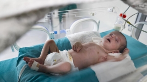 Nehir bebek '25 binde 1' görülen hastalıkla mücadeleyi Türkiye'de kazandı