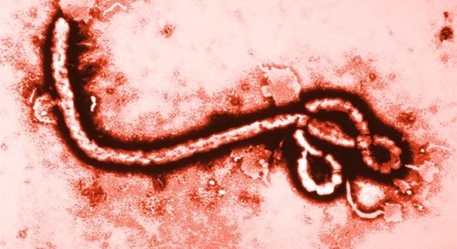 Afrika ülkeleri Ebola virüsü ile ortak mücadele edecek