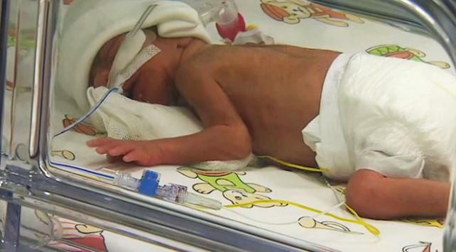 Türkiye'de 4 bin bebekten biri hipotiroidi ile dünyaya geliyor