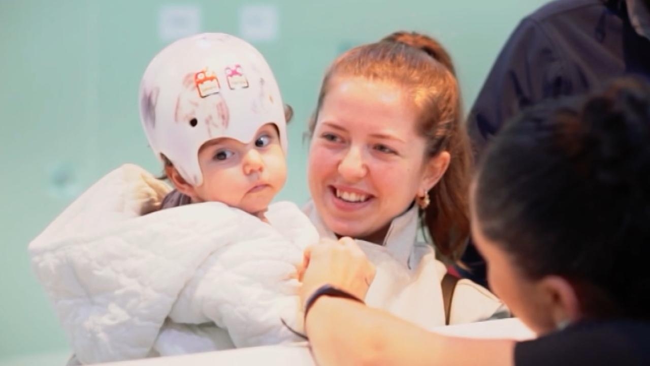 Çocuklarda kafatası şekil bozukluğu zeka geriliğine neden olabiliyor