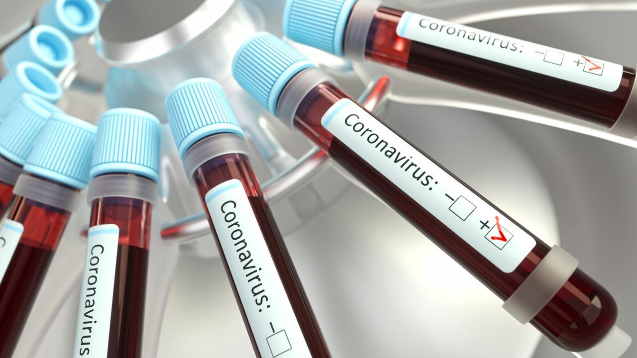 Hidroksiklorokin ilacı koronavirüs tedavisinde kullanılmayacak