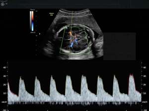 Geç Dönem Fetal  Muayene