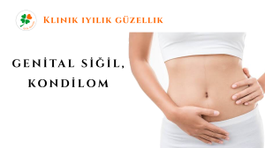 Genital Siğil, Kondilom Nişantaşı