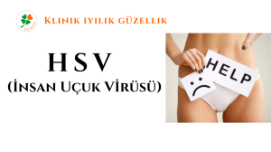 HSV ( İNSAN UÇUK VİRÜSÜ ), HERPES, GENİTAL HERPES, GENİTAL UÇUK