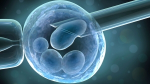 KISIRLIK (İNFERTİLİTE), TÜP BEBEK (IVF)