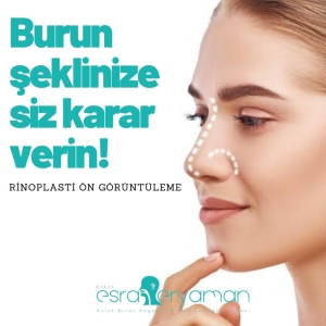 Rinoplastide yüze uyumlu burun