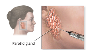 Tükürük Bezi Tümörlerinin Tanısı